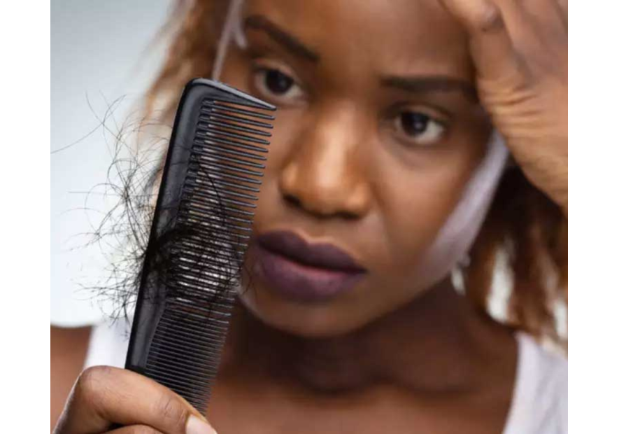 Chute de cheveux : comment la stopper ?